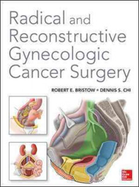 Radical & Reconstructive Gynecologic Cancer Surgery
