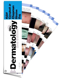 Dermatology DDx Deck, 2nd ed.
