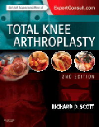 Total Knee Arthroplasty, 2nd ed.