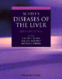 Schiff's Diseases of the Liver, 11th ed.
