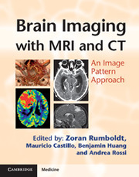 Brain Imaging with MRI & CT- An Image Pattern Approach