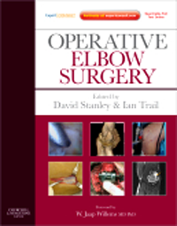 Operative Elbow Surgery