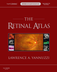 Retinal AtlasWith Expert Consult