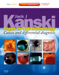 Signs in Ophthalmology- Causes & Differential DiagnosisWith Expert Consult