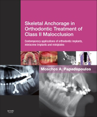 Skeletal Anchorage in Orthodontic Treatment of ClassII Malocclusion- Contemporary Applications of Orthodontic Implants,Miniscrew Implants and Miniplates