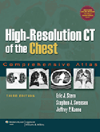 High-Resolution CT of the Chest, 3rd ed.- Comprehensive Atlas