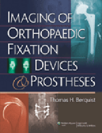 Imaging of Orthopaedic Fixation Devices & Prostheses