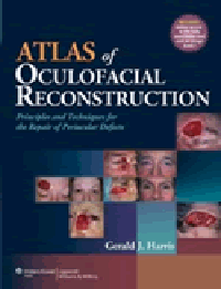 Atlas of Oculofacial Reconstruction- Principles & Techniques for the Repair of PeriocularDefects
