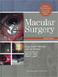 Macular Surgery, 2nd ed.