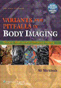 Variants & Pitfalls in Body Imaging, 2nd ed.- Thoracic, Abdominal & Women's Imaging
