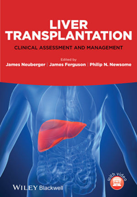 Liver Transplantation- Clinical Assessment & Management