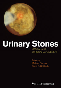 Urinary Stones- Medical & Surgical Management
