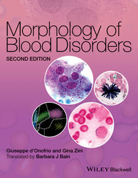 Morphology of Blood Disorders, 2nd ed.
