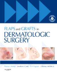 Flaps & Grafts in Dermatologic Surgery, with DVD