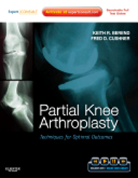 Partial Knee Arthroplasty- Techniques for Optimal Outcomes with DVD