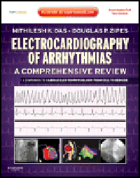 Electrocardiography of Arrhythmias- A Comprehensive Review