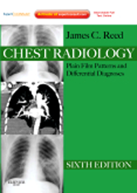Chest Radiology, 6th ed.- Plain Film Patterns & Differential Diagnoses