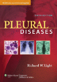 Pleural Diseases, 6th ed.