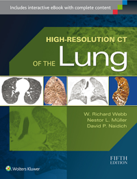 High-Resolution CT of the Lung, 5th ed.