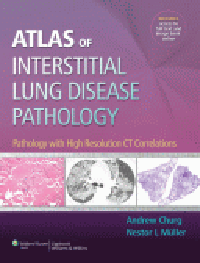Atlas of Interstitial Lung Disease Pathology- Pathology with High Resolution CT Correlations
