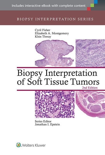 biopsy interpretation of soft tissue tumors 2nd ed 洋書 南江堂 biopsy interpretation of soft tissue tumors 2nd ed 洋書 南江堂