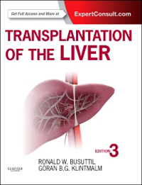Transplantation of the Liver, 3rd ed.