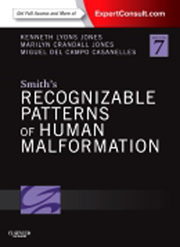 Smith's Recognizable Patterns of Human Malformation,7th ed.(With Online Access to Expert Consult)