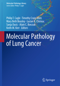 Molecular Pathology of Lung Cancer(Molecular Pathology Library Vol.6)