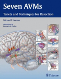 Seven AVMs- Tenets & Techniques for Resection
