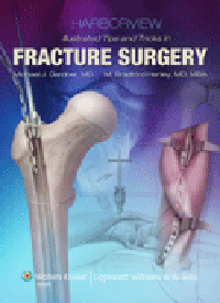 Harborview Illustrated Tips & Tricks in FractureSurgery