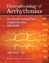 Electrophysiology of Arrhythmias- Practical Images for Diagnosis & Ablation