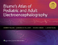 Blume's Atlas of Pediatric & AdultElectroencephalography