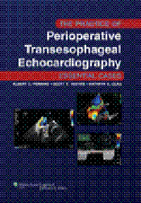 Practice of Perioperative TransesophagealEchocardiography- Essential Cases