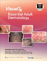 VisualDx: Essential Adult Dermatology