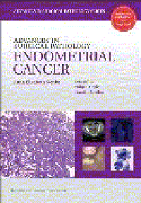 Advances in Surgical Pathology: Endometrial Cancer