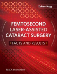 Femtosecond Laser-Assisted Cataract Surgery- Facts & Results