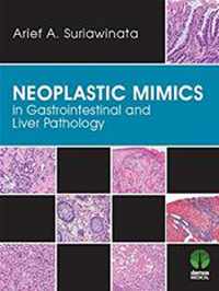 Neoplastic Mimics in Gastrointestinal & Liver Pathology