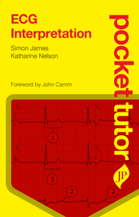 Pocket Tutor: ECG Interpretation