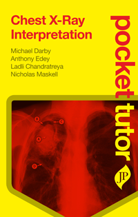 Pocket Tutor: Chest X-Ray Interpretation