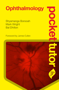 Pocket Tutor: Ophthalmology