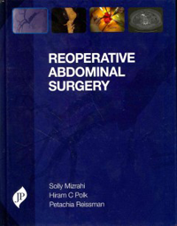 Reoperative Abdominal Surgery