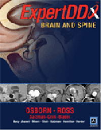 Expert Differential Diagnoses: Brain & Spine
