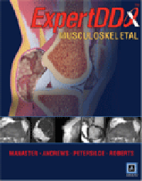 Expert Differential Diagnoses: Musculoskeletal