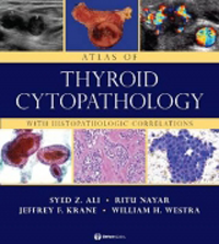 Atlas of Thyroid Cytopathology with HistopathologicCorrelations