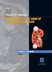 Pitfalls & Classic Signs of Abdomen & Pelvis(Specialty Imaging Series)