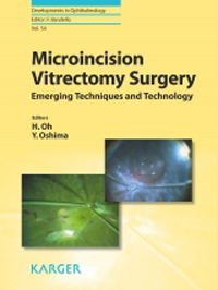 Microincision Vitrectomy Surgery- Emerging Techniques & Technology(Developments in Ophthalmology, Vol.54)