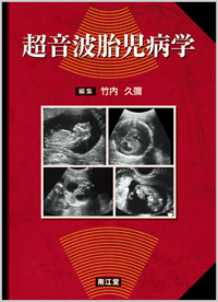 超音波胎児病学