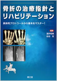 骨折の治療指針とリハビリテーション
