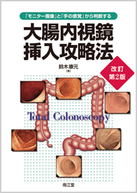 「モニター画像」と「手の感覚」から判断する大腸内視鏡挿入攻略法改訂第2版