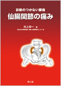仙腸関節の痛み